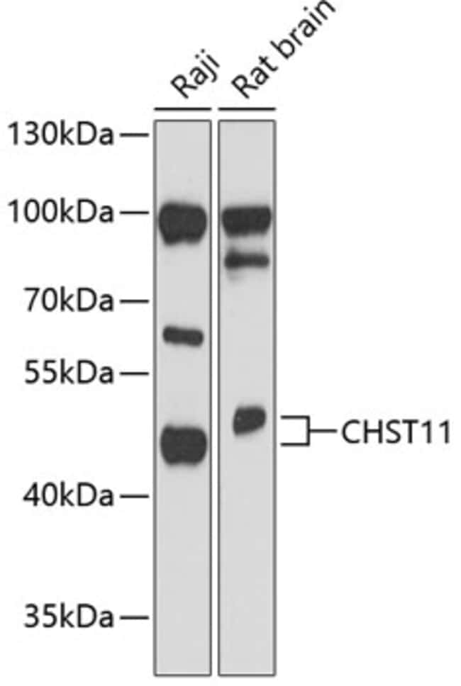 100UL CHST11 ANTIBODY 100 ul