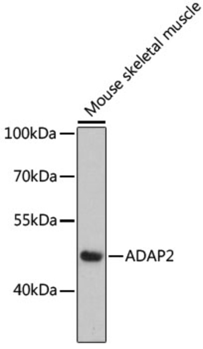 100UL CENTAURIN ALPHA-2 ANTIBODY 100 ul