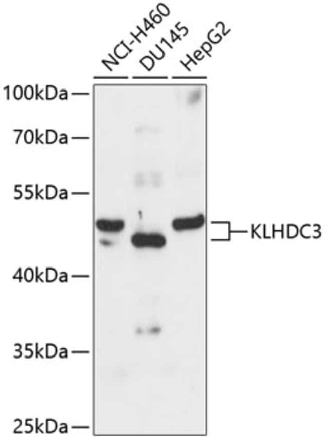 100UL KLDC3 ANTIBODY 100 ul