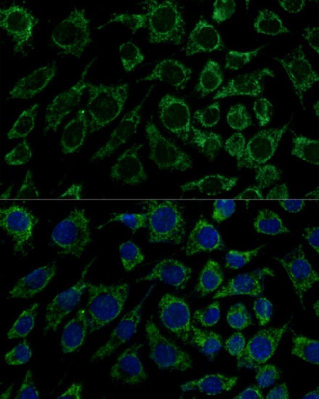 100UL IDH3B ANTIBODY 100 ul