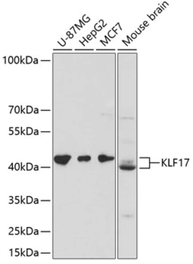 100UL KLF17 ANTIBODY 100 ul