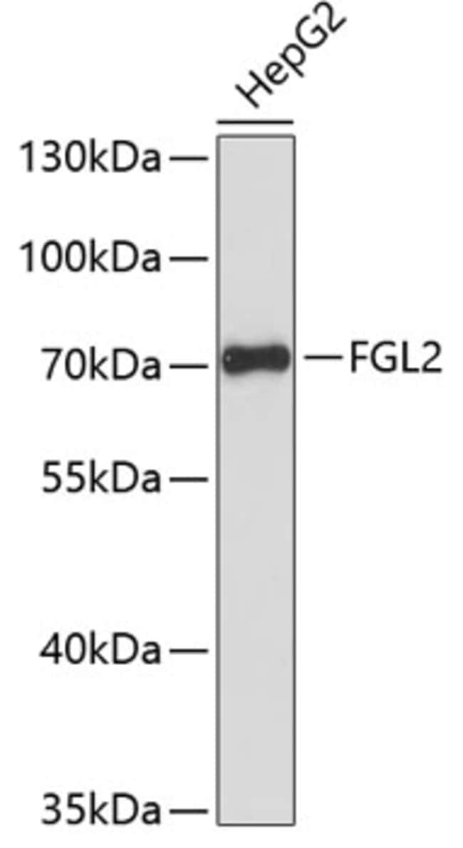 100UL FGL2 ANTIBODY 100 ul