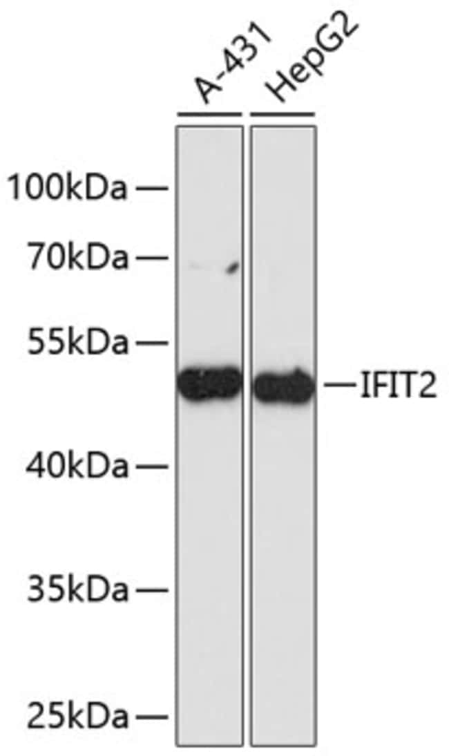 100UL IFIT2 ANTIBODY 100 ul
