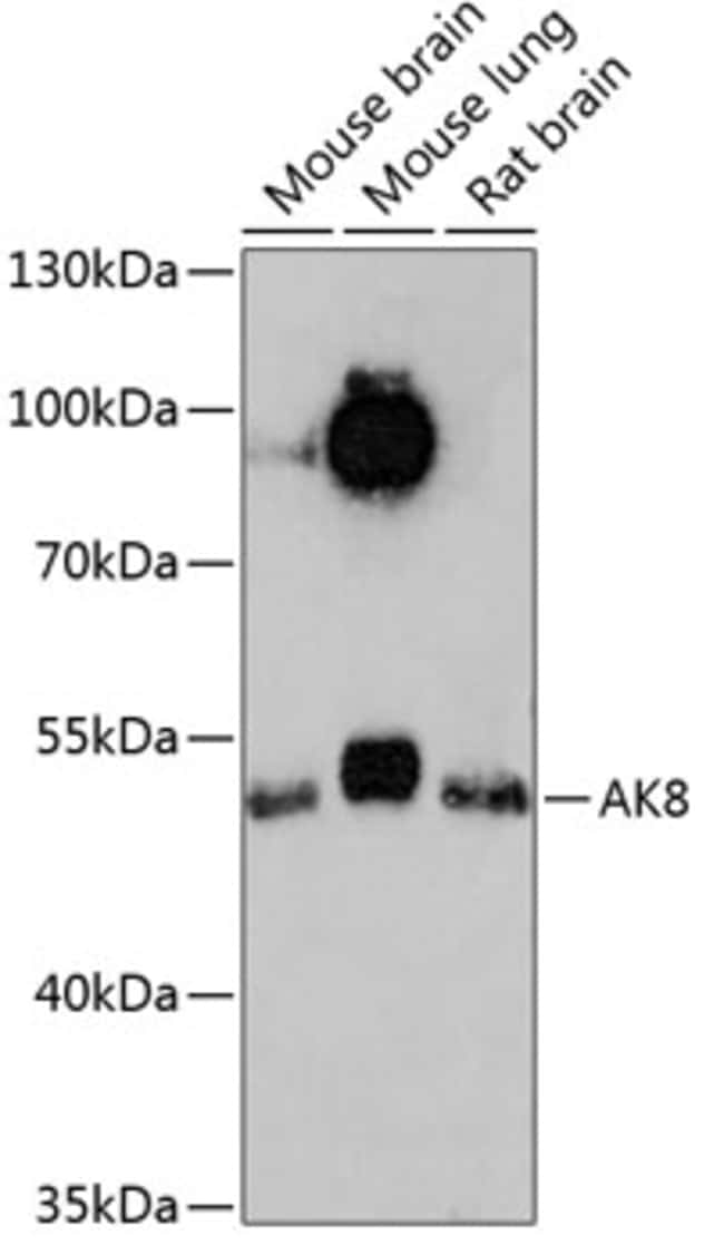 100UL ADENYLATE KINASE 8 ANTIBODY 100 ul