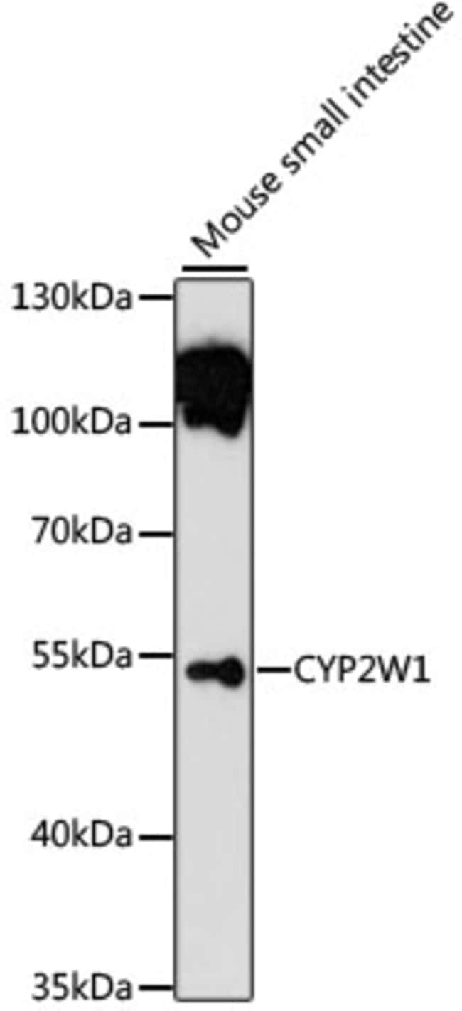 100UL CYP2W1 ANTIBODY 100 ul