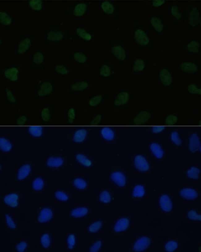 100UL HSF1 ANTIBODY 100 ul