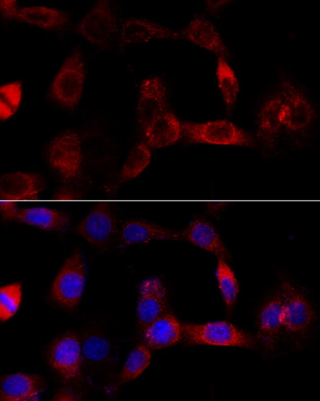 100UL CYP1B1 ANTIBODY 100 ul