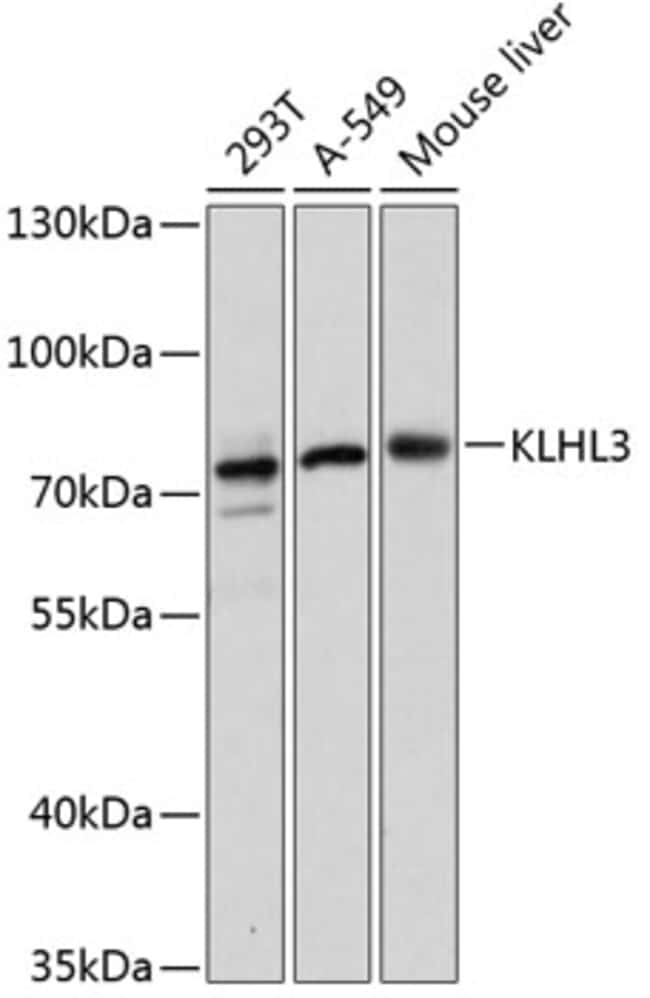 100UL KLHL3 ANTIBODY 100 ul