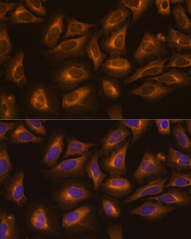 100UL KARS ANTIBODY 100 ul