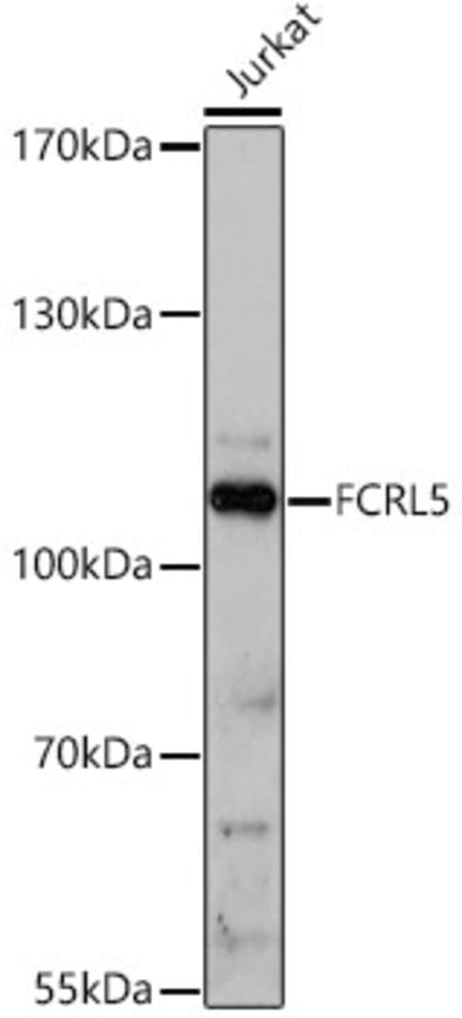 100UL FCRL5 ANTIBODY 100 ul
