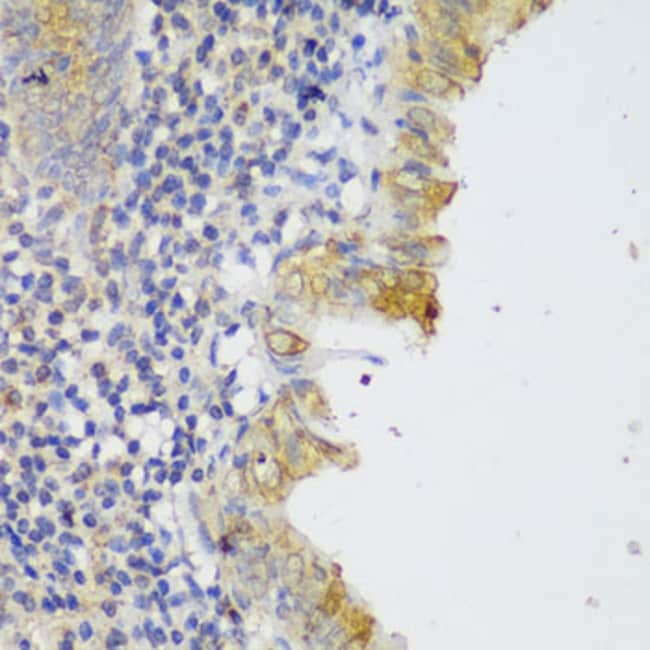 100UL GCC2 ANTIBODY 100 ul