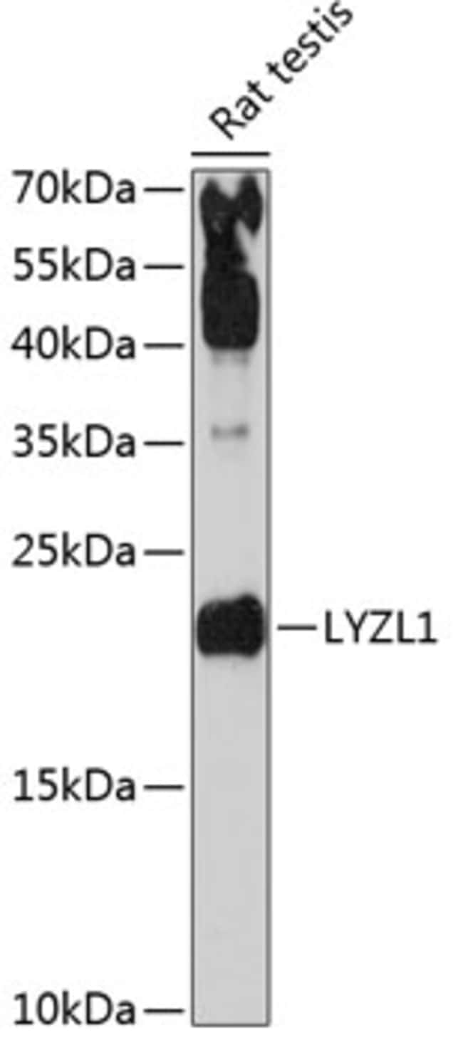100UL LYZL1 ANTIBODY 100 ul