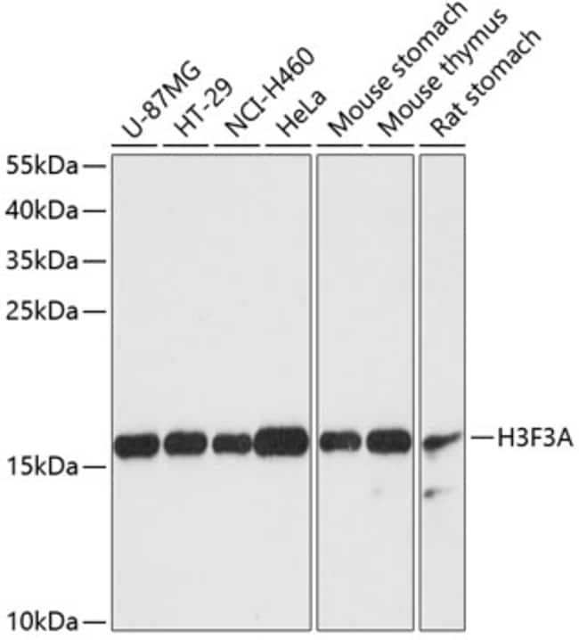 100UL HISTONE H3.3 ANTIBODY 100 ul