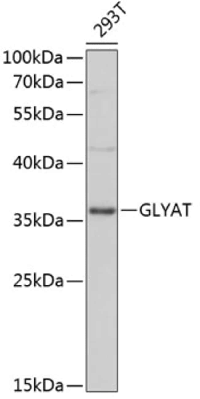 100UL GLYAT ANTIBODY 100 ul