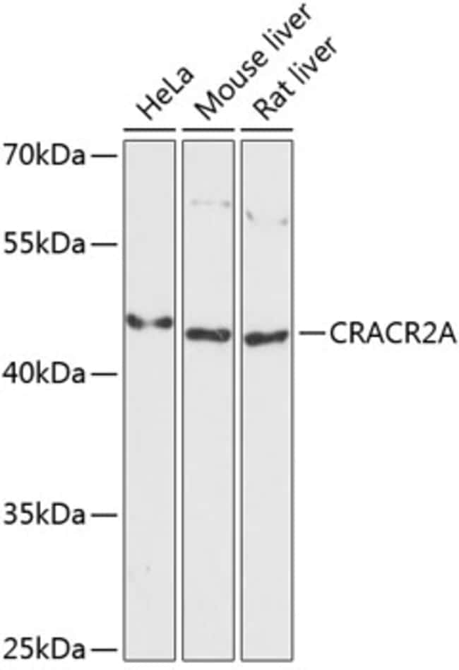 100UL EFCAB4B ANTIBODY 100 ul