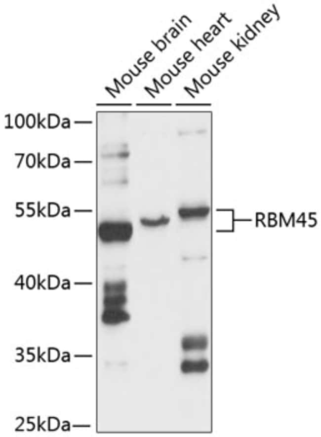 100UL DRB1 ANTIBODY 100 ul