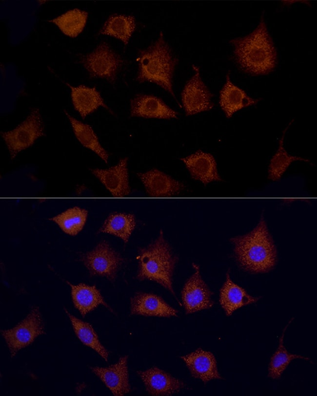 100UL CPT1C ANTIBODY 100 ul