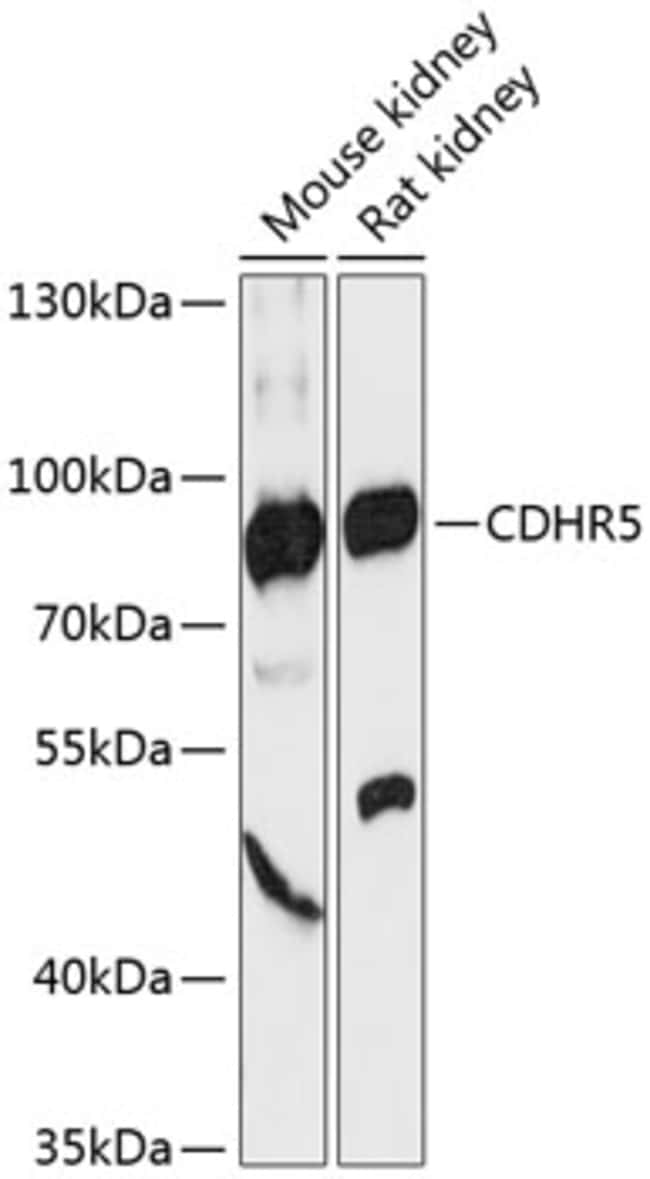 100UL CDHR5 ANTIBODY 100 ul