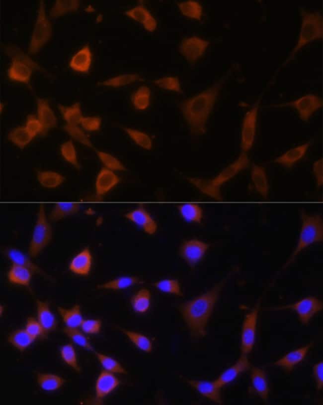 100UL GANAB ANTIBODY 100 ul