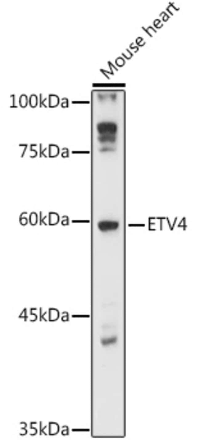 100UL ETV4 ANTIBODY 100 ul
