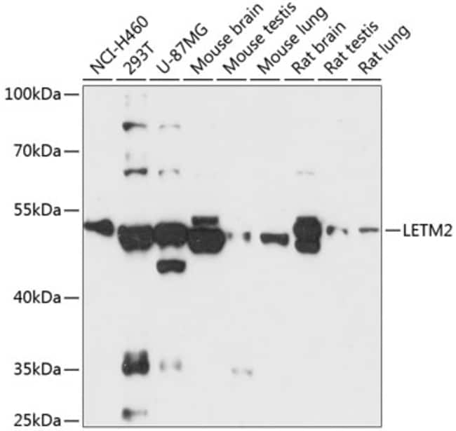 100UL LETM2 ANTIBODY 100 ul