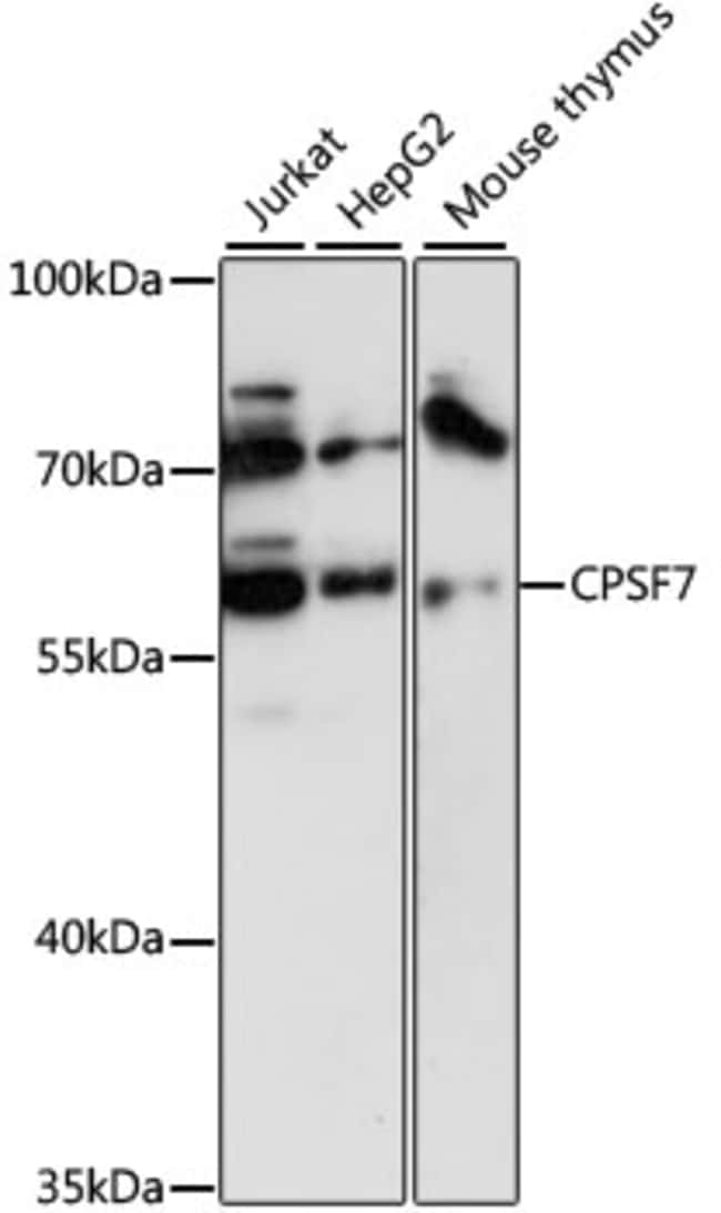 100UL CPSF7 ANTIBODY 100 ul