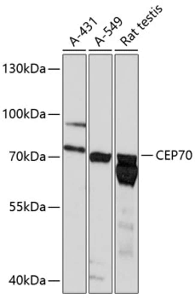 100UL BITE ANTIBODY 100 ul