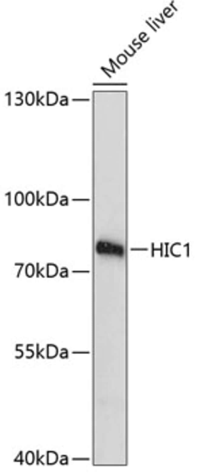 100UL HIC1 ANTIBODY 100 ul