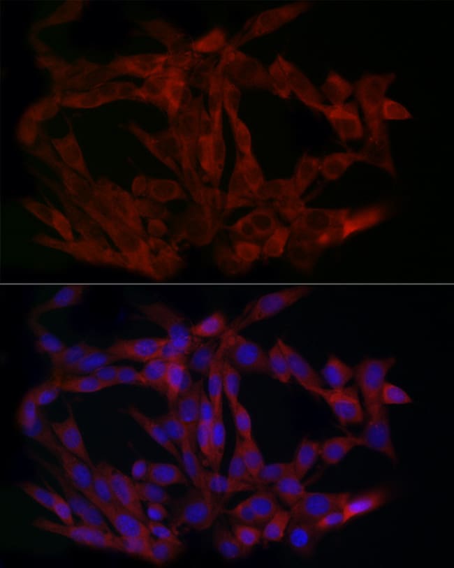 100UL LIMS1 ANTIBODY 100 ul