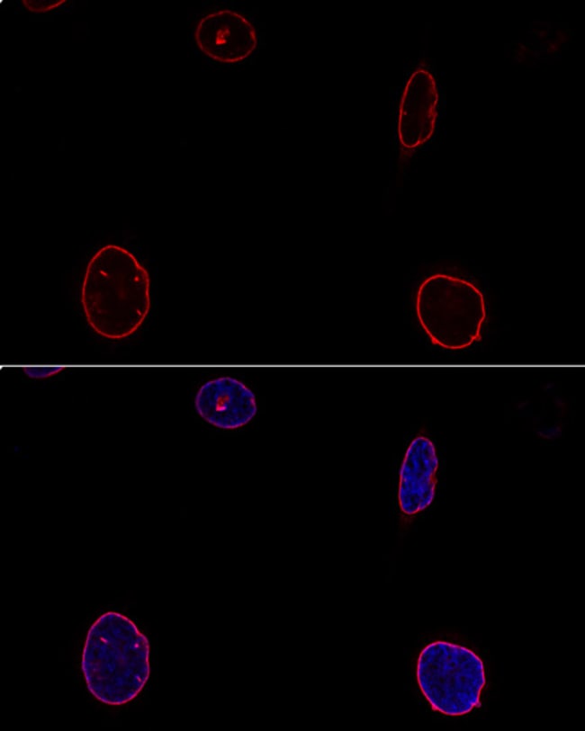 100UL EMERIN ANTIBODY 100 ul
