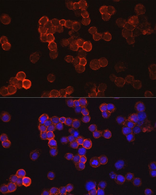 100UL CD34 ANTIBODY 100 ul