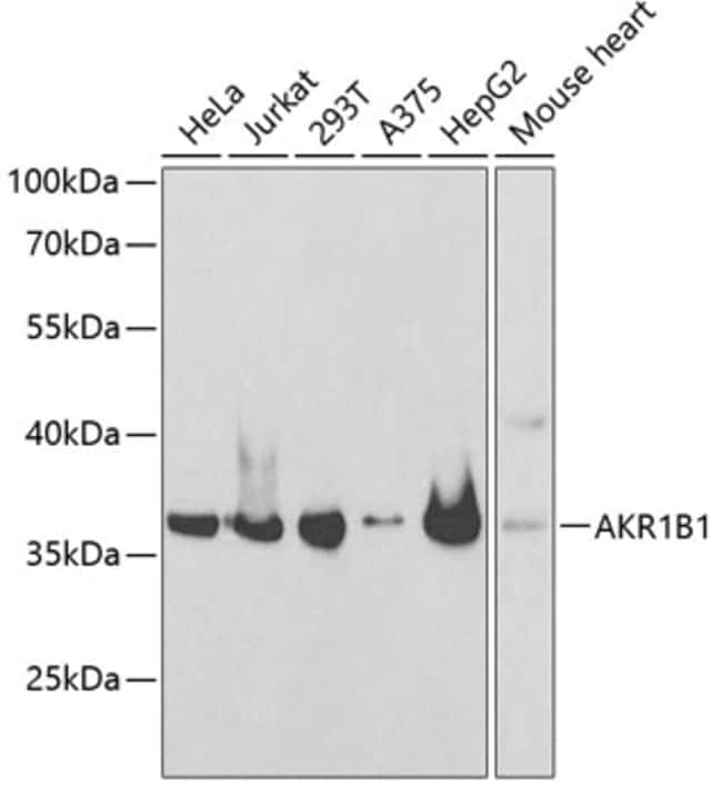 100UL AKR1B1 ANTIBODY 100 ul