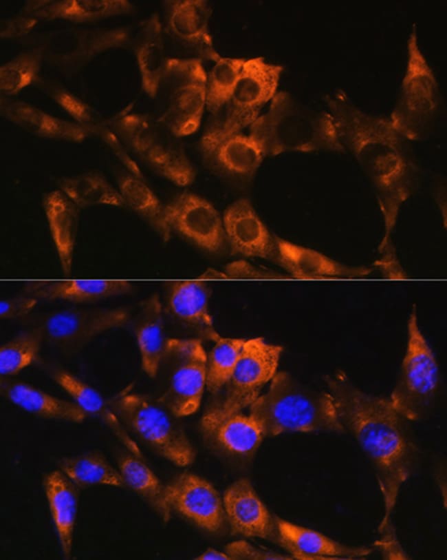 100UL APRT ANTIBODY 100 ul
