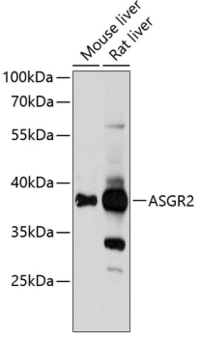 100UL ASGR2 ANTIBODY 100 ul