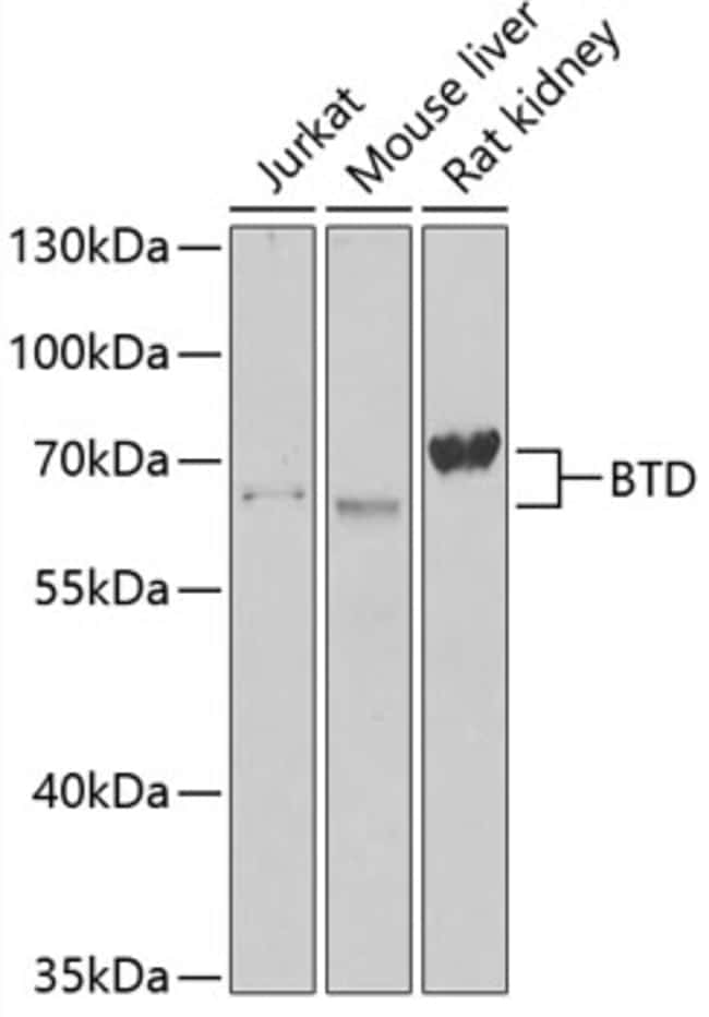 100UL BTD ANTIBODY 100 ul