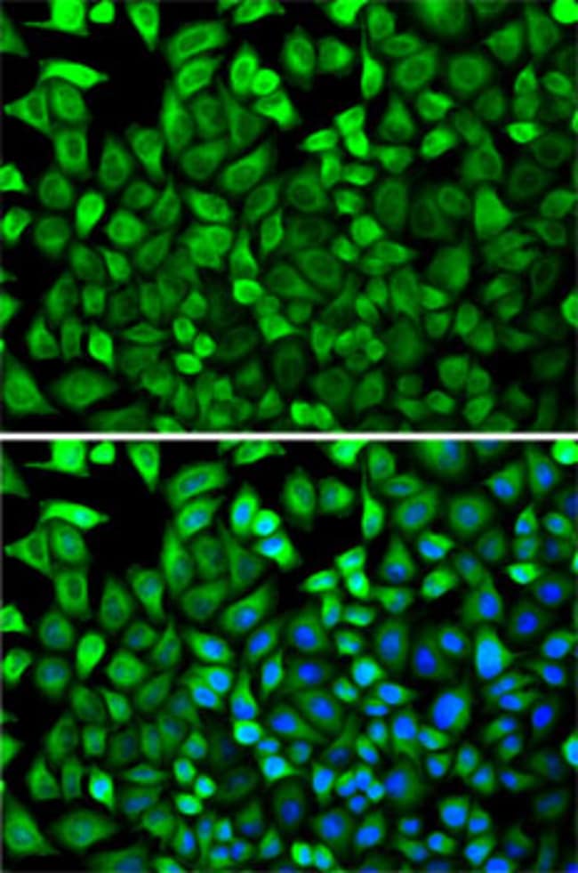 100UL CDA ANTIBODY 100 ul