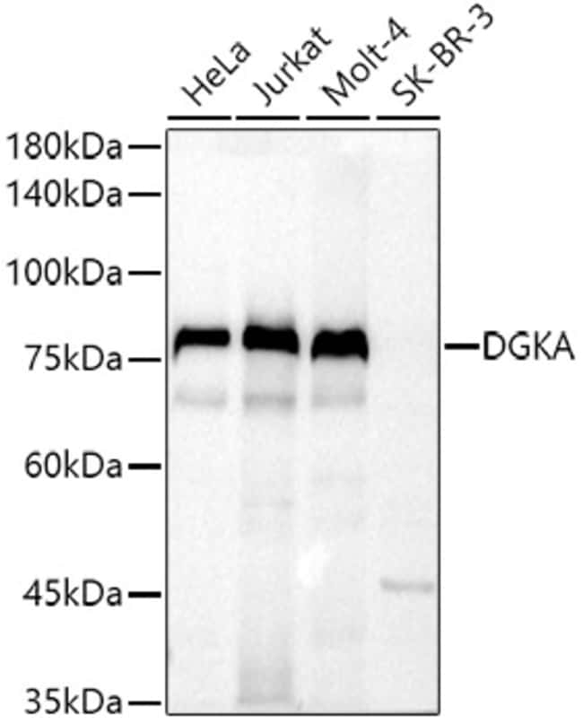 100UL DGKA ANTIBODY 100 ul