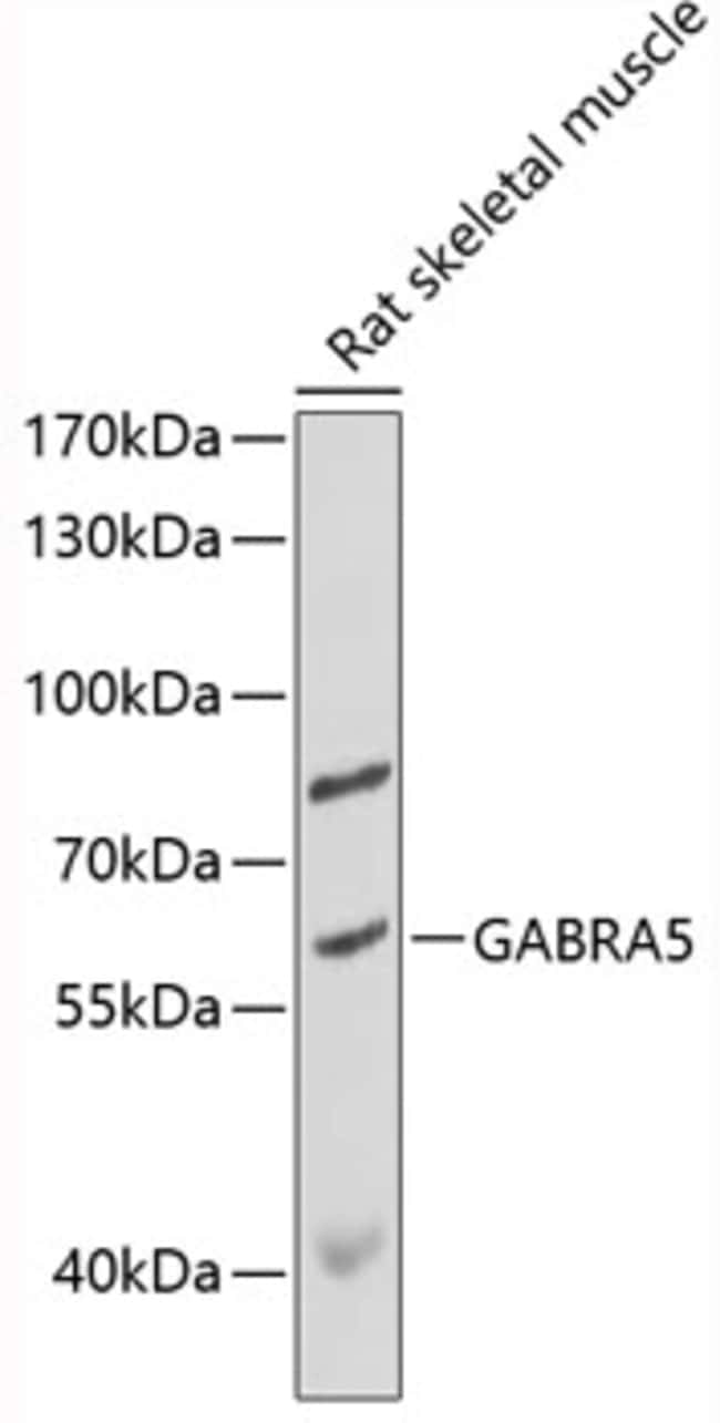 100UL GABRA5 ANTIBODY 100 ul