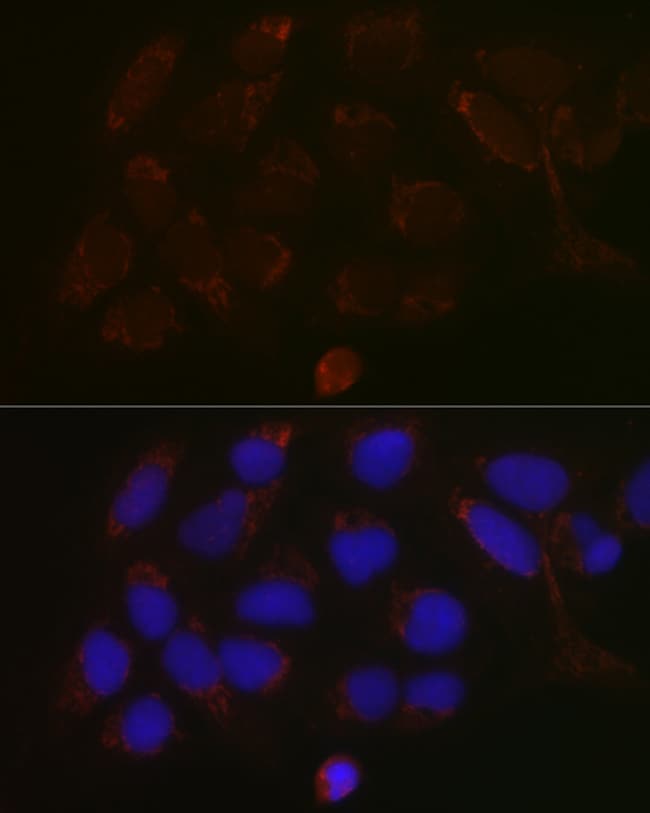 100UL GALNT3 ANTIBODY 100 ul