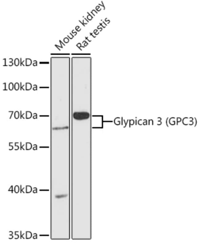 100UL GLYPICAN 3 ANTIBODY 100 ul