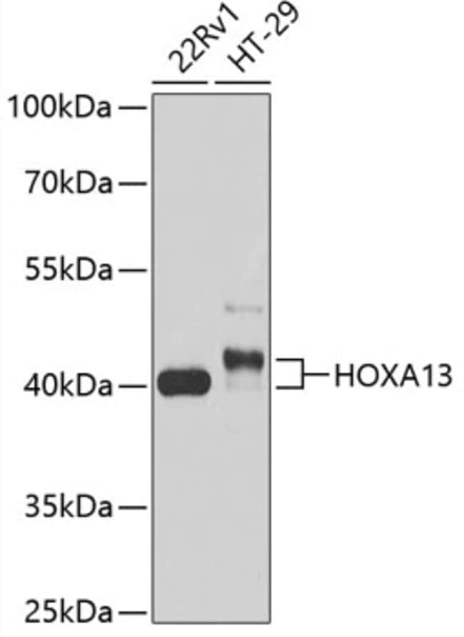 100UL HOXA13 ANTIBODY 100 ul