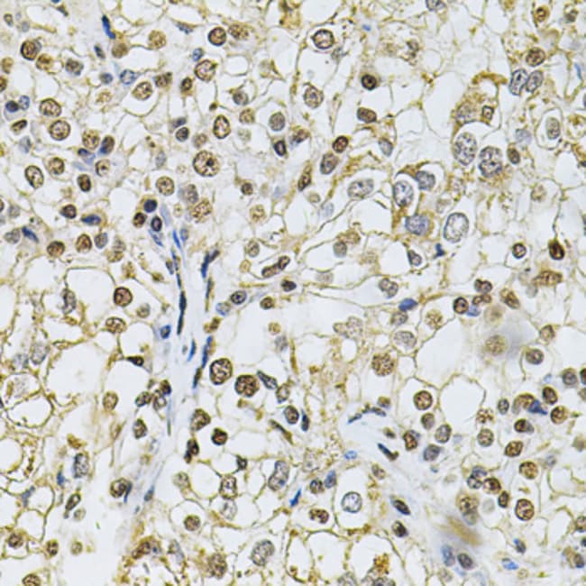 100UL IFI16 ANTIBODY 100 ul