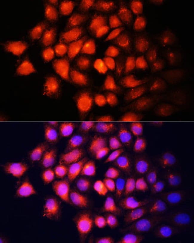 100UL IGF2 ANTIBODY 100 ul
