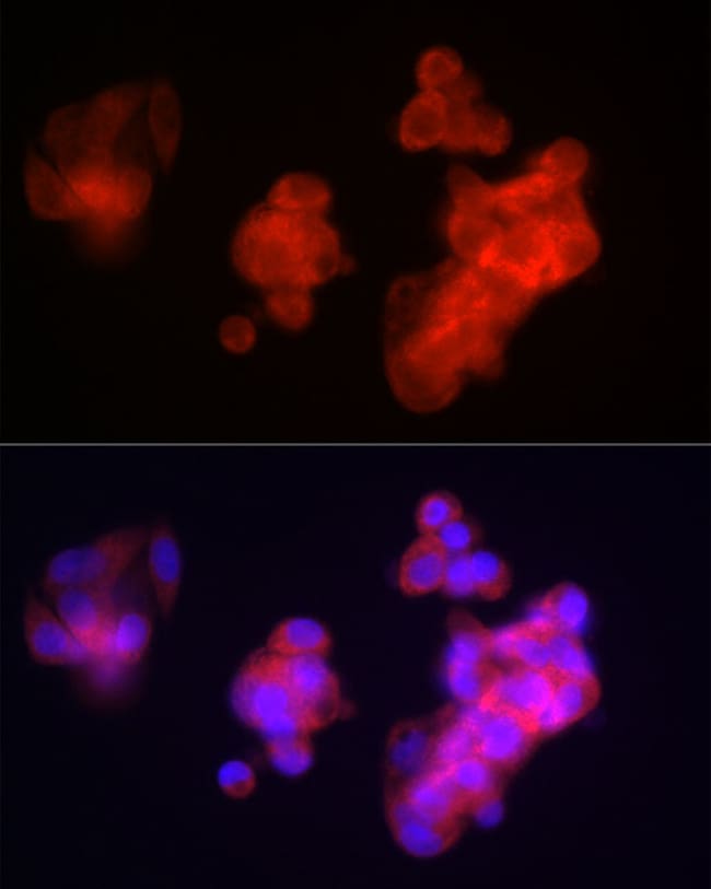 100UL FIBB ANTIBODY 100 ul