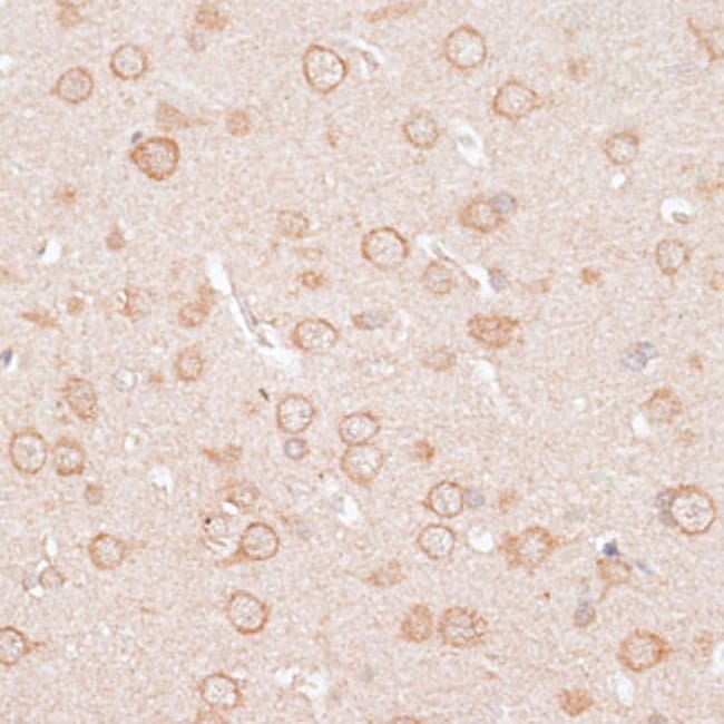 100UL KIR2.3 (KCNJ4) ANTIBODY 100 ul