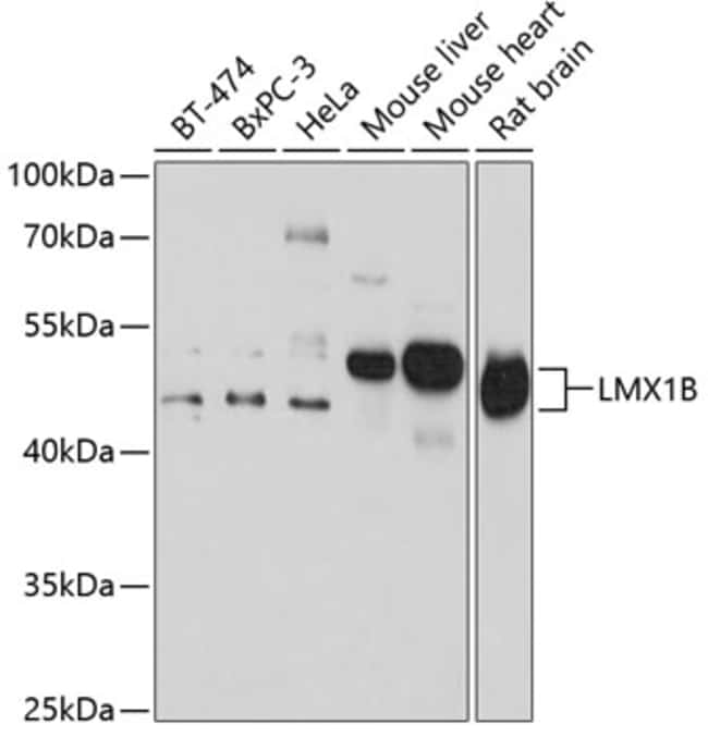 100UL LMX1B ANTIBODY 100 ul
