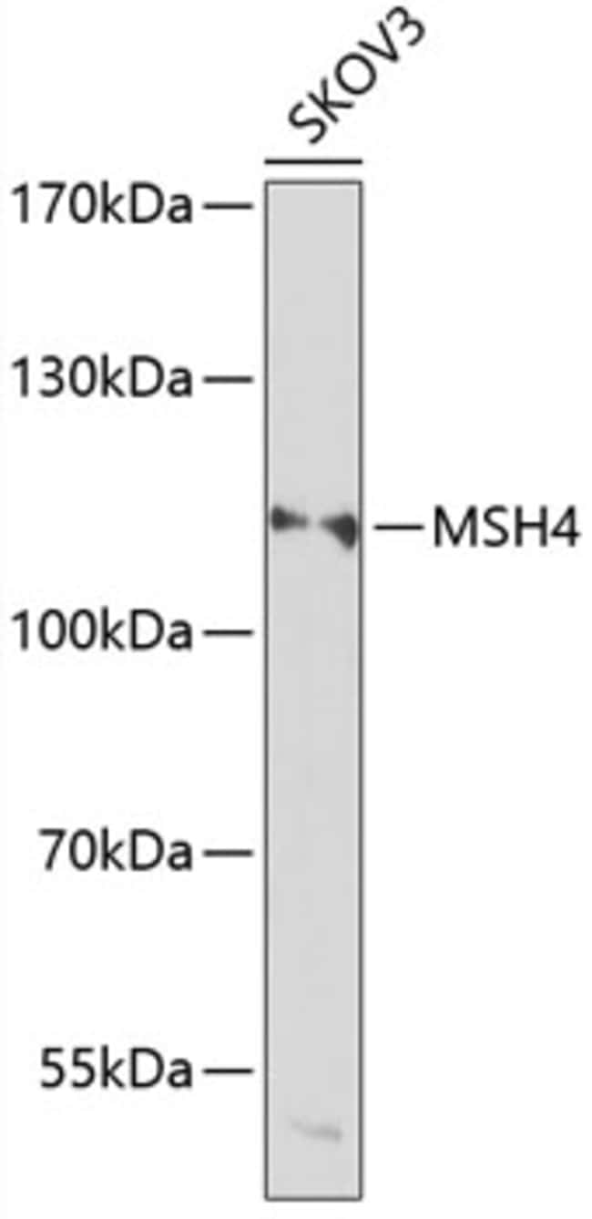 100UL MSH4 ANTIBODY 100 ul