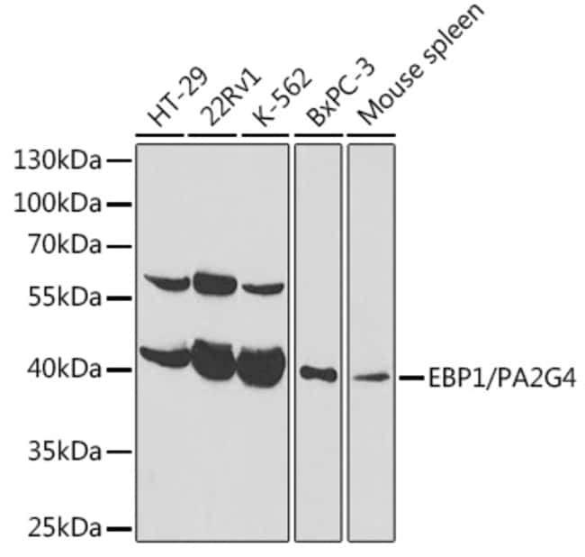 100UL EBP1 ANTIBODY 100 ul