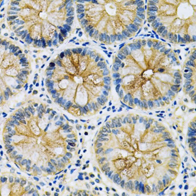 100UL MASPIN ANTIBODY 100 ul