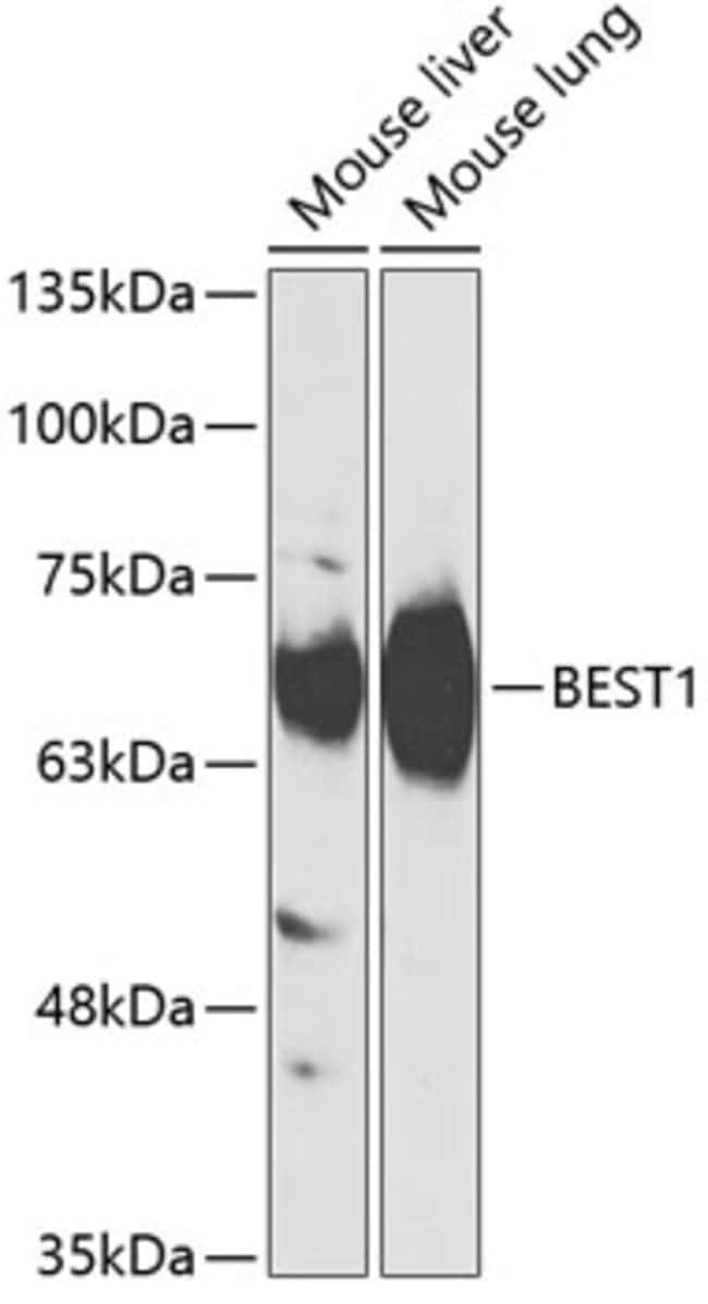 100UL BESTROPHIN 1 ANTIBODY 100 ul